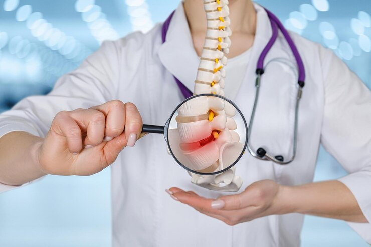 SmartCare360 | Osteoporosis - Image Name SmartCare360 | Osteoporosis - Image Name
