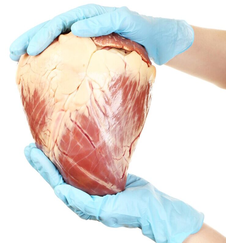 SmartCare360 | Coronary Artery Disease - Image Name SmartCare360 | Coronary Artery Disease - Image Name